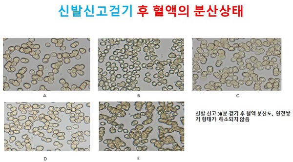 신발 신고 30분 걷기 후 혈액 분산도, 연전쌓기 형태가 해소되지 않음.
