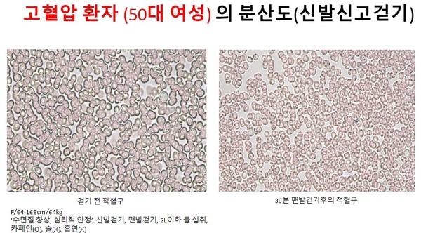 F/64-168cm/64kg‘수면질 향상, 심리적 안정’, 신발걷기, 맨발걷기, 2L이하 물 섭취, 카페인(O), 술(X), 흡연(X)