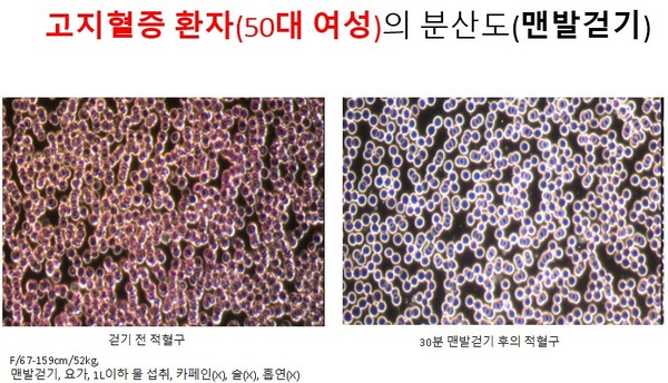 F/67-159cm/52kg, 맨발걷기, 요가, 1L이하 물 섭취, 카페인(X), 술(X), 흡연(X)