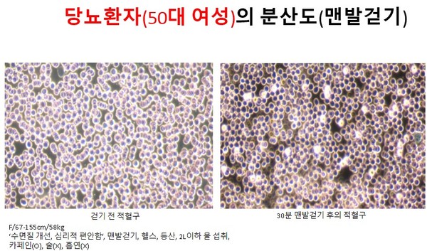F/67-155cm/58kg‘수면질 개선, 심리적 편안함‘, 맨발걷기, 헬스, 등산, 2L이하 물 섭취, 카페인(O), 술(X), 흡연(X)