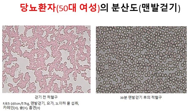 F/65-160cm/57kg, 맨발걷기, 요가, 2L이하 물 섭취, 카페인(X), 술(X), 흡연(X)