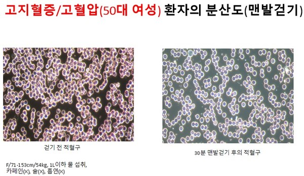 F/71-153cm/54kg, 1L이하 물 섭취, 카페인(X), 술(X), 흡연(X)