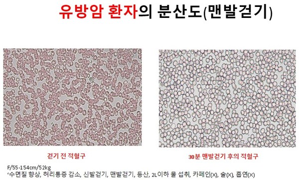 F/55-154cm/52kg‘수면질 향상, 허리통증 감소, 신발걷기, 맨발걷기, 등산, 2L이하 물 섭취, 카페인(X), 술(X), 흡연(X)
